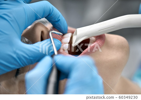 Beautiful woman's teeth cleaning in dental clinic 60349230