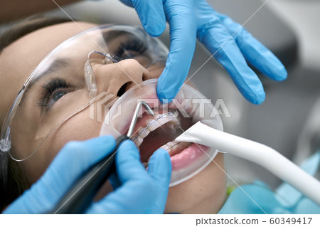 Pretty woman's teeth cleaning in dental clinic 60349417