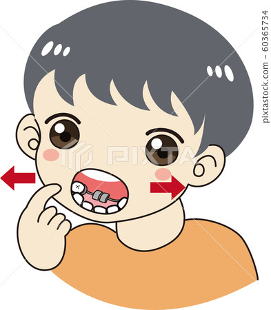 Child orthodontic appliance jaw ago enlargement plate device enlargement floor 1st term treatment boy Child orthodontic appliance jaw ago enlargement plate device enlargement floor 1st term treatment boy 60365734
