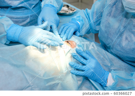 Close up of surgery team operating. The operation on the eye. Cataract surgery. Laser vision correction. Patient and team of surgeons in the operating room, patient under sterile cover 60366027