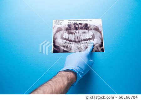 A dentist holding snapshot the patient's tooth and indicates the problem. Panoramic shot of the jaw on a blue isolated background. 60366704