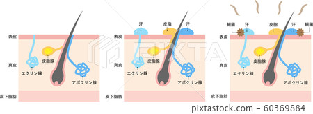 Causes of body odor and sweat glands 60369884