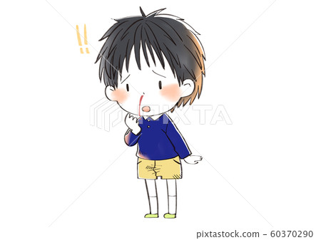 nosebleed nosebleed 60370290