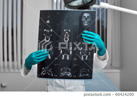 Doctor attentively examines the MRI scan of the patient. 60424200