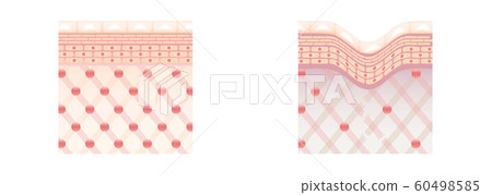 皮膚視圖橫截面比較 60498585