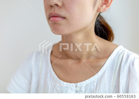 女性頸部格雷夫斯病 女性頸部格雷夫斯病 60558163