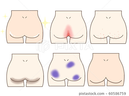 屁股套 屁股套 60586759