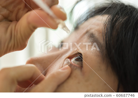 Woman use eye drop, artificial tears to the eye Woman use eye drop, artificial tears to the eye 60687746