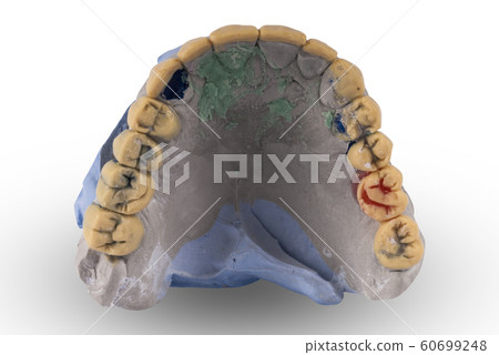 Gypsum model of human jaw isolated Gypsum model of human jaw isolated 60699248