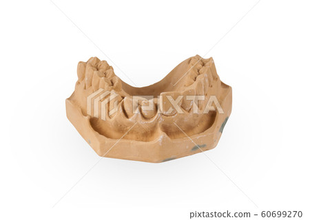 Gypsum model of human jaw 60699270