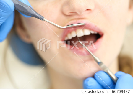 Closeup of face of female who undergo detntist checkup Closeup of face of female who undergo detntist checkup 60709487