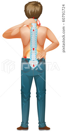 Back of man and his back pain 60791724