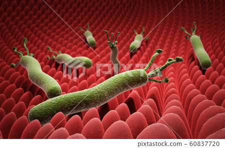 helicobacter pylori on the surface of the stomach 60837720