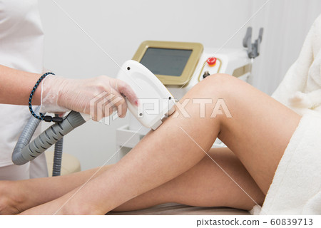 Laser epilation of legs Laser epilation of legs 60839713