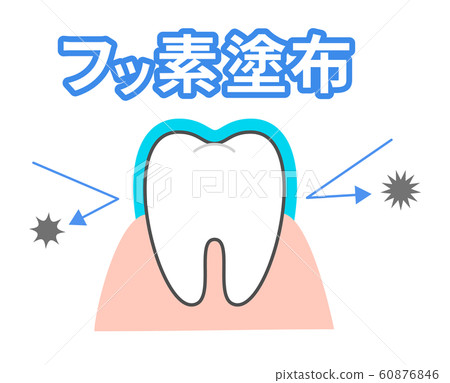 Effect of fluorine treatment Toothed character Dental illustration 60876846