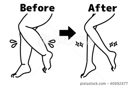 Thick and thin legs-calf-before and after-black Thick and thin legs-calf-before and after-black 60892877