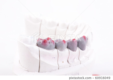 Dental Prosthesis work. Artificial tooth, prosthetic, false teeth 60916049