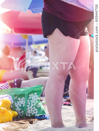 Woman legs with red sunburn skin on the beach Woman legs with red sunburn skin on the beach 60944706