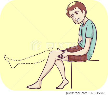 Man Joint Lack Range Motion Illustration 60945366