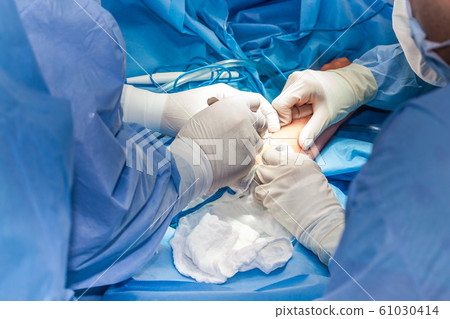 Group of surgeons performing an elbow surgery Group of surgeons performing an elbow surgery 61030414