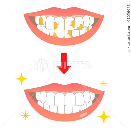 Whitening Yellowish Before After 61056628
