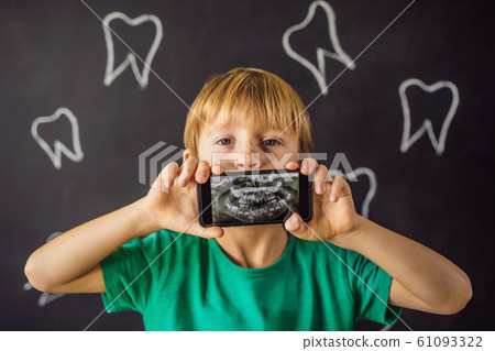 The boy shows his X-ray image of his teeth with an abnormally strange extra tooth. Children's The boy shows his X-ray image of his teeth with an abnormally strange extra tooth. Children's 61093322