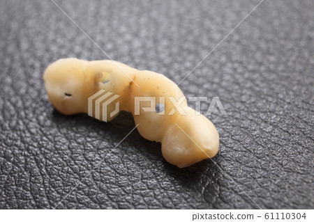 Dentures, temporary teeth 61110304