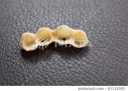 Dentures, temporary teeth 61110305