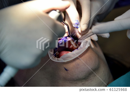 Dental care check up, Dentist examining and doing teeth treatment in dental clinic. 61125988