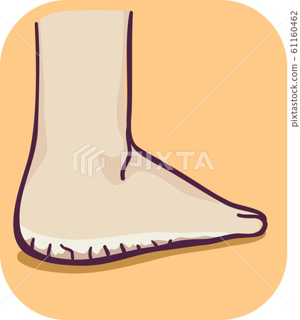 Foot Thick Dry Skin Illustration 61160462