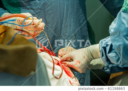 Operation of trepanation of the skull. 61198663