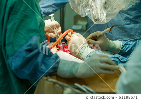 hands of surgeons with tools. 61198671