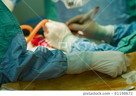 close-up of the  assistant surgeon's hand. 61198672