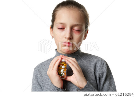 Allergic reaction, skin rash, close view portrait Allergic reaction, skin rash, close view portrait 61216294
