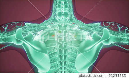 3D magnetic resonance image scan 61251385