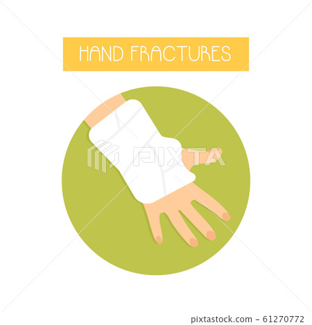 Illustration of a fractured hand with a cast. 61270772