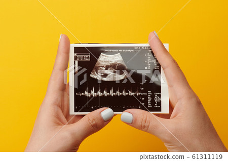 Woman hold picture of her baby Woman hold picture of her baby 61311119