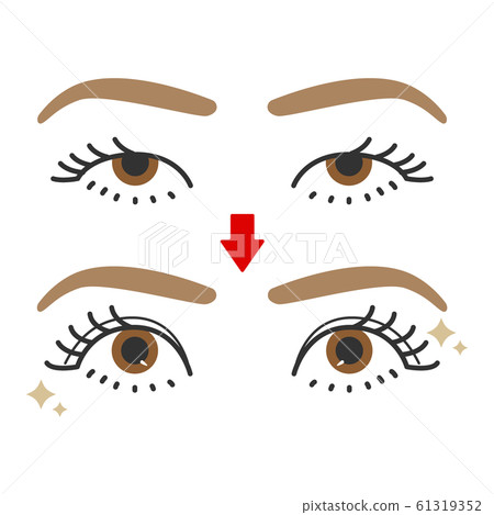 Eyes: single, double, before and after 61319352