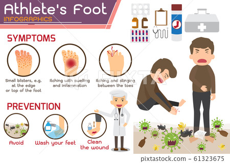 Hong Kong Foot Disease Stock Illustration 61323675 Pixta
