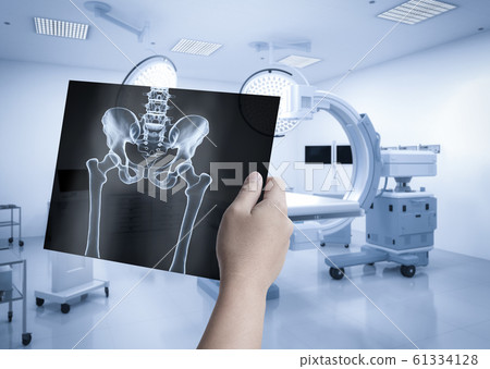 X-ray film diagnosis X-ray film diagnosis 61334128