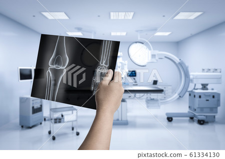 X-ray film diagnosis 61334130