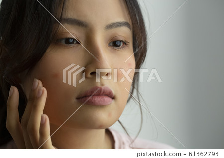 皮膚粗糙的女性 皮膚粗糙的女性 61362793