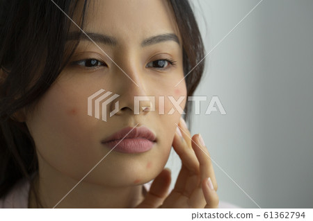 皮膚粗糙的女性 皮膚粗糙的女性 61362794