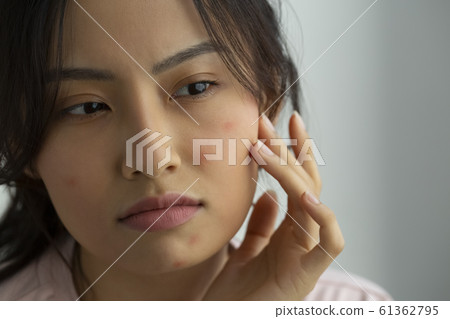 皮膚粗糙的女性 61362795