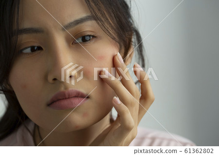 Female suffering from rough skin Female suffering from rough skin 61362802