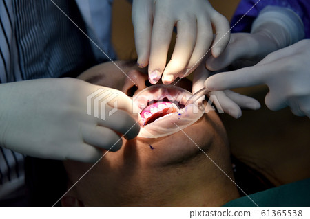 Dental care check up, Dentist examining and doing teeth treatment in dental clinic. 61365538
