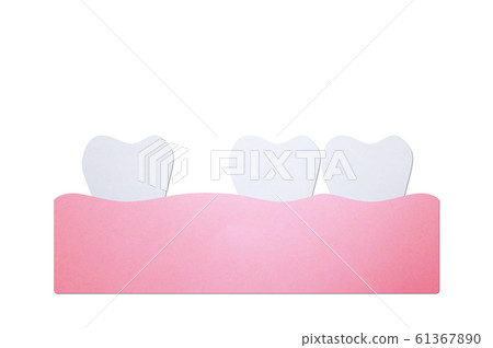 spacing teeth (diastema), dental problem spacing teeth (diastema), dental problem 61367890