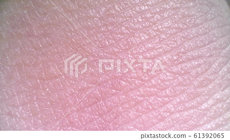 Skin measurement image 61392065