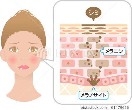 污點女人的皮膚結構 61479656