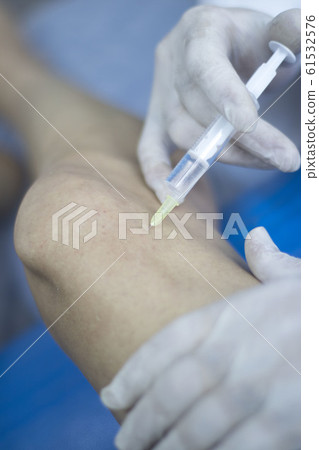 EPI needling physical therapy EPI needling physical therapy 61532576